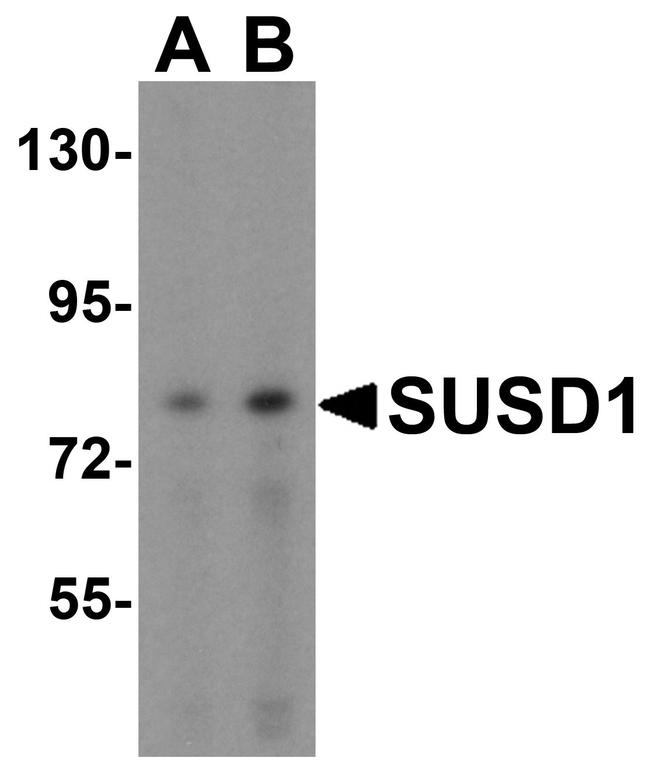 SUSD1 Antibody in Western Blot (WB)