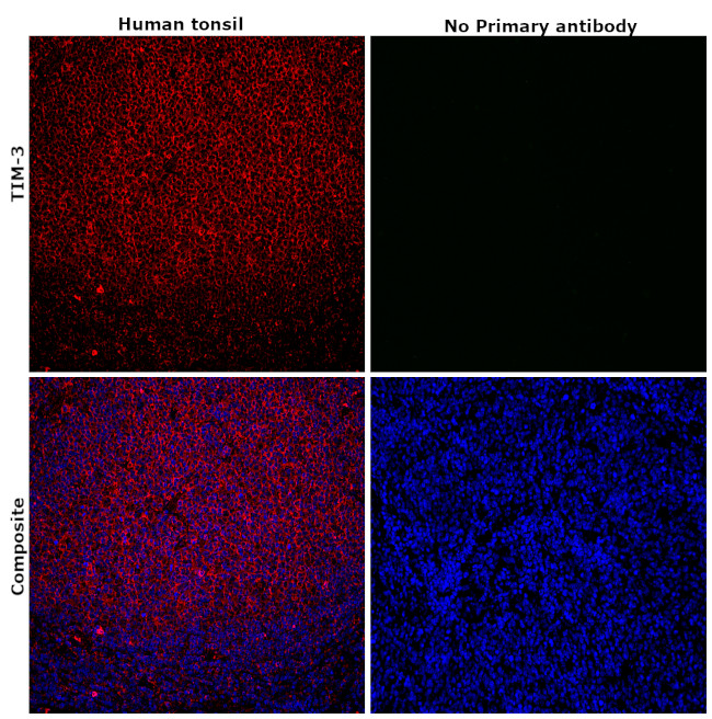 TIM-3 Antibody in Immunohistochemistry (Paraffin) (IHC (P))