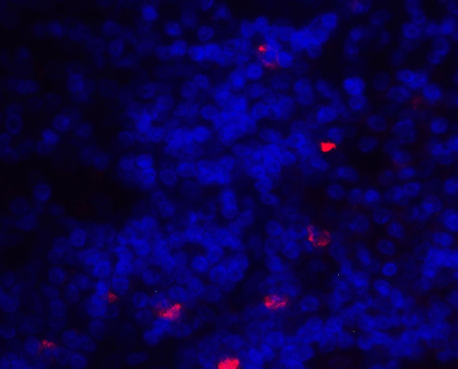 CD275 (B7-H2) Antibody in Immunohistochemistry (IHC)