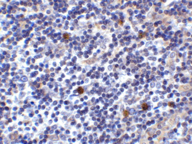 CD275 (B7-H2) Antibody in Immunohistochemistry (IHC)