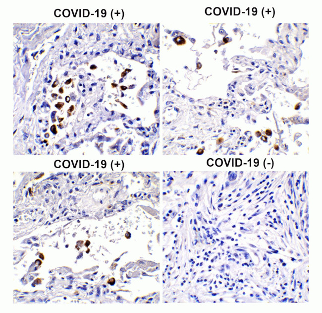 SARS-CoV-2 Spike Protein S1 Antibody in Immunohistochemistry (Paraffin) (IHC (P))