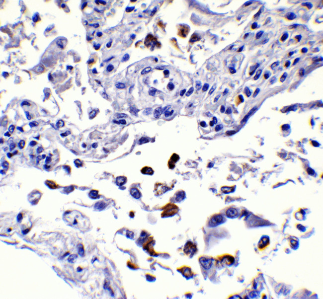 SARS-CoV-2 Spike Protein S1 Antibody in Immunohistochemistry (Paraffin) (IHC (P))