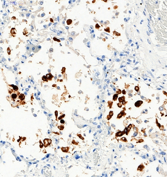 SARS-CoV-2 Spike Protein S1 Antibody in Immunohistochemistry (Paraffin) (IHC (P))