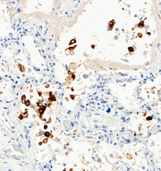 SARS-CoV-2 Spike Protein S1 Antibody in Immunohistochemistry (Paraffin) (IHC (P))