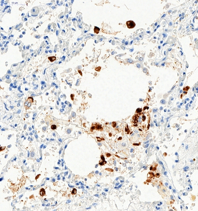 SARS-CoV-2 Spike Protein S1 Antibody in Immunohistochemistry (Paraffin) (IHC (P))