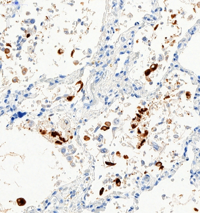 SARS-CoV-2 Spike Protein S1 Antibody in Immunohistochemistry (Paraffin) (IHC (P))