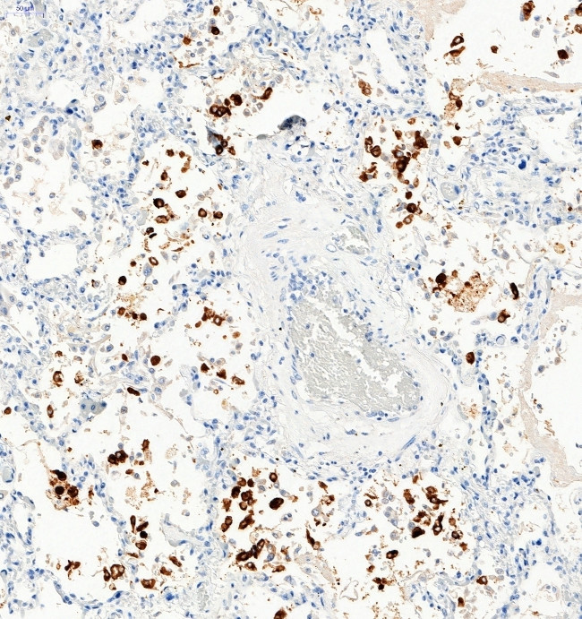 SARS-CoV-2 Spike Protein S1 Antibody in Immunohistochemistry (Paraffin) (IHC (P))