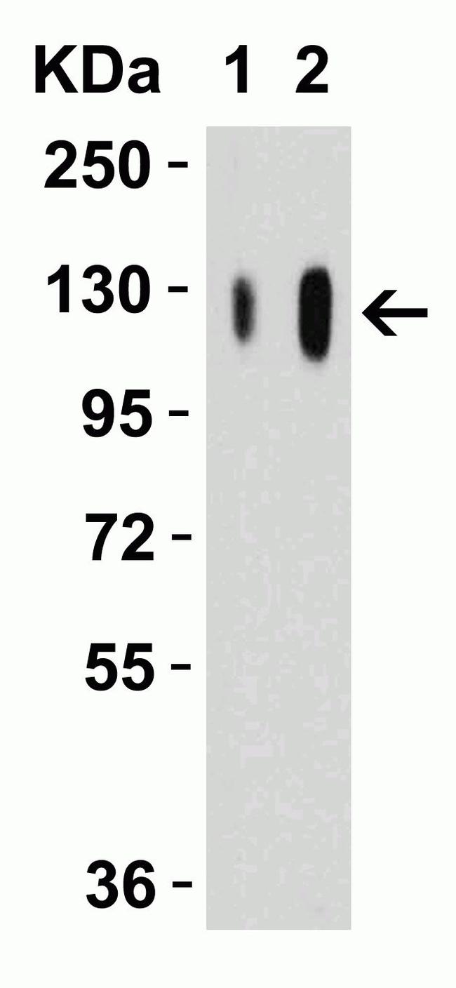 SARS-CoV-2 Spike Protein S1 Antibody in Western Blot (WB)