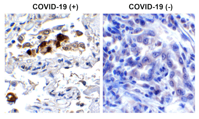 SARS-CoV-2 Spike Protein (RBD) Antibody in Immunohistochemistry (Paraffin) (IHC (P))