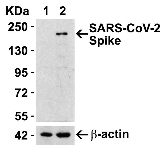 SARS-CoV-2 Spike Protein (RBD) Antibody in Western Blot (WB)