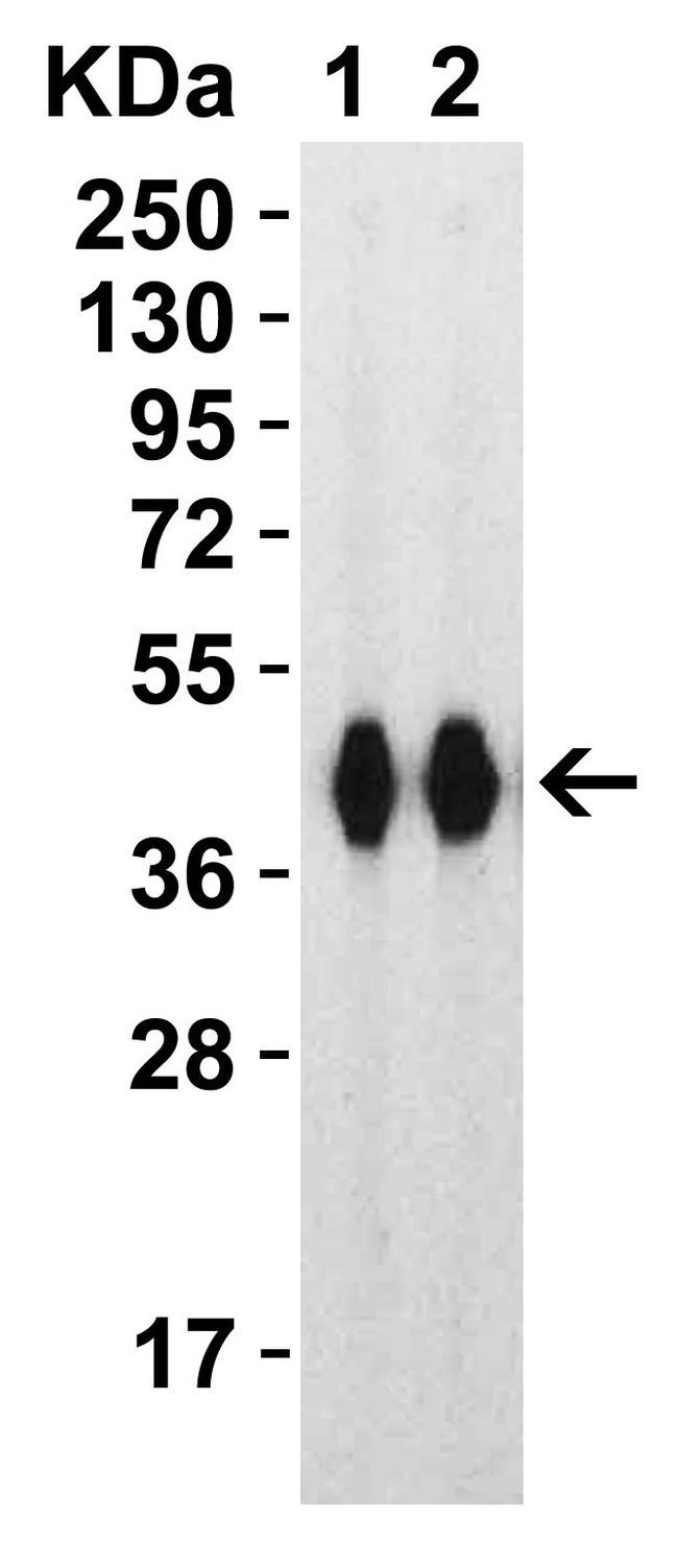 SARS-CoV-2 Spike Protein (RBD) Antibody in Western Blot (WB)