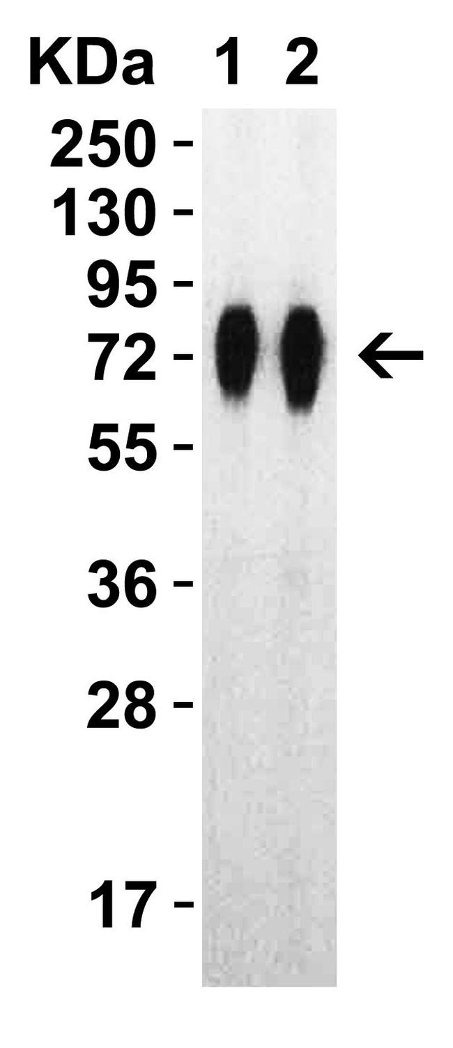 SARS-CoV-2 Spike Protein (RBD) Antibody in Western Blot (WB)