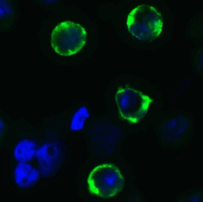 SARS-CoV-2 Spike Protein S1 Antibody in Immunocytochemistry (ICC/IF)