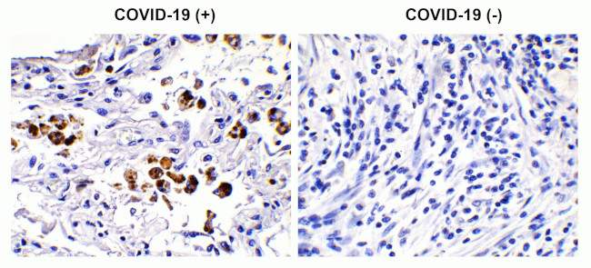 SARS-CoV-2 Spike Protein S2 Antibody in Immunohistochemistry (Paraffin) (IHC (P))