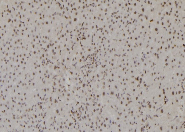 H3K27me3 Antibody in Immunohistochemistry (Paraffin) (IHC (P))