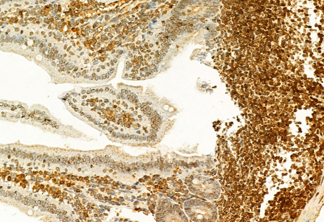 H3K27me3 Antibody in Immunohistochemistry (Paraffin) (IHC (P))