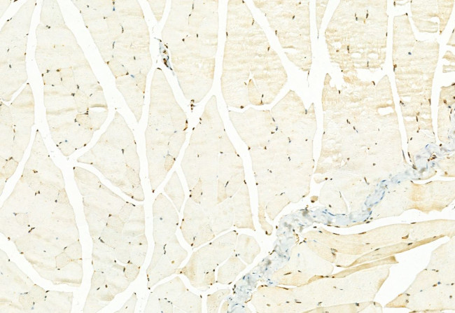 H3K27me3 Antibody in Immunohistochemistry (Paraffin) (IHC (P))