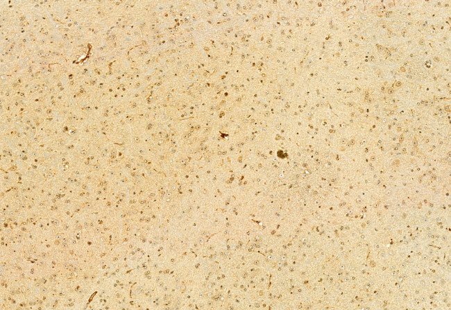 H3K27me3 Antibody in Immunohistochemistry (Paraffin) (IHC (P))