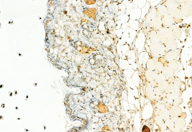 H3K27me3 Antibody in Immunohistochemistry (Paraffin) (IHC (P))