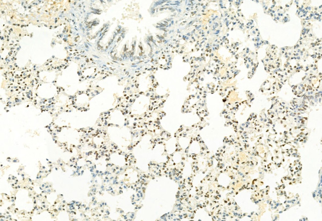 H3K27me3 Antibody in Immunohistochemistry (Paraffin) (IHC (P))