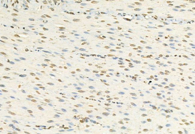 H3K27me3 Antibody in Immunohistochemistry (Paraffin) (IHC (P))