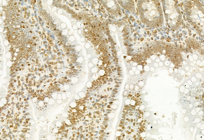 H3K27me3 Antibody in Immunohistochemistry (Paraffin) (IHC (P))