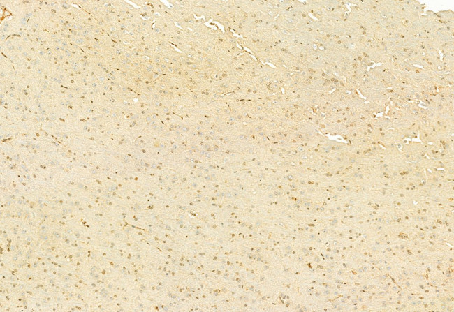 H3K27me3 Antibody in Immunohistochemistry (Paraffin) (IHC (P))