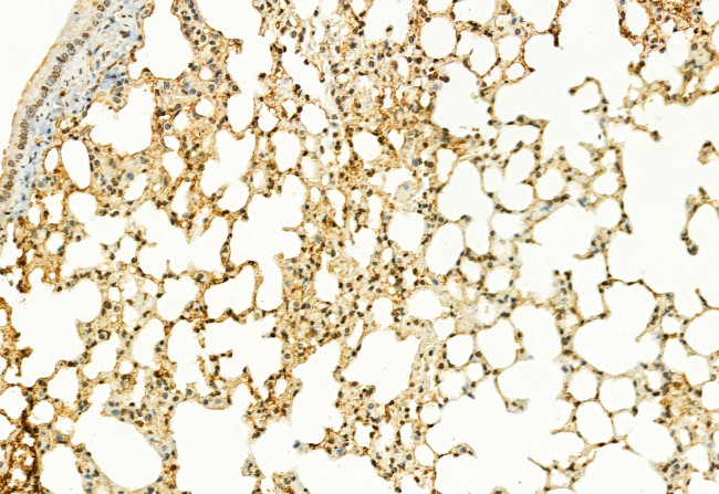 H3K27me3 Antibody in Immunohistochemistry (Paraffin) (IHC (P))