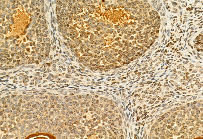 H3K27me3 Antibody in Immunohistochemistry (Paraffin) (IHC (P))