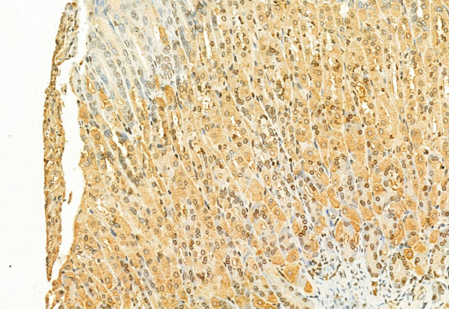 H3K27me3 Antibody in Immunohistochemistry (Paraffin) (IHC (P))