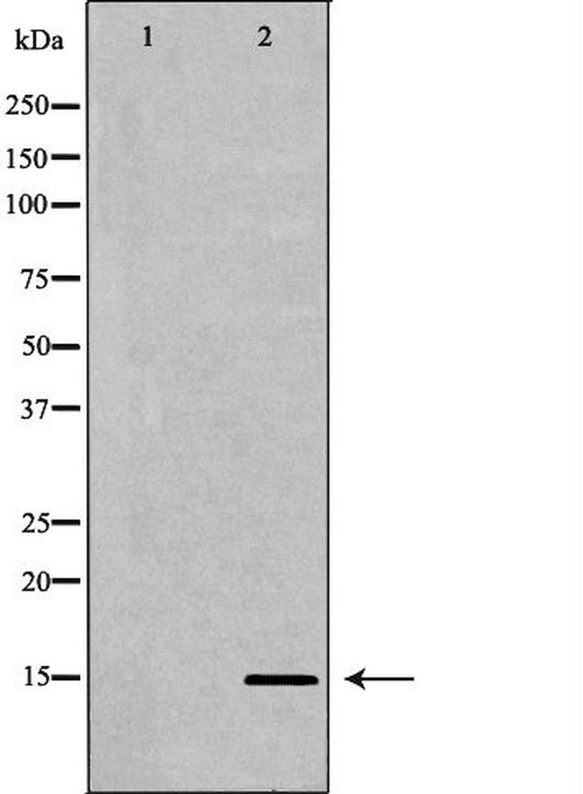 H3K27me3 Antibody in Western Blot (WB)