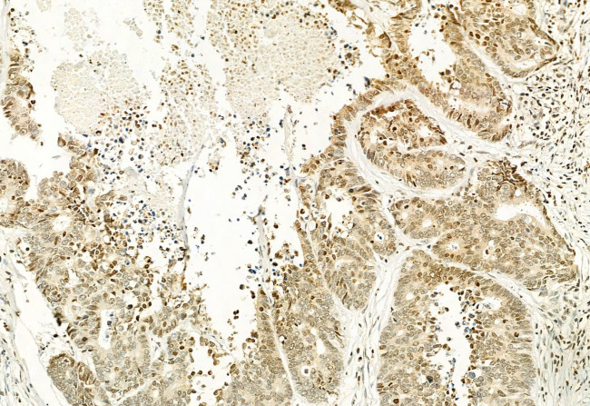 H3K4me3 Antibody in Immunohistochemistry (Paraffin) (IHC (P))