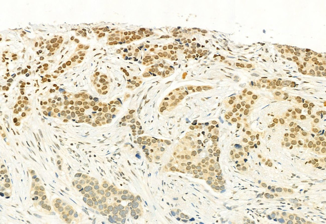 H3K4me3 Antibody in Immunohistochemistry (Paraffin) (IHC (P))