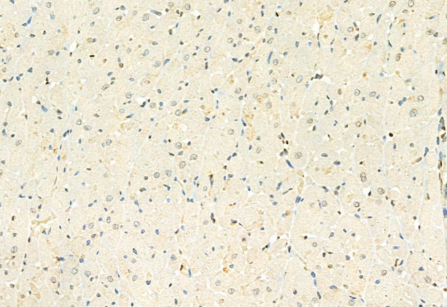 H3K4me3 Antibody in Immunohistochemistry (Paraffin) (IHC (P))