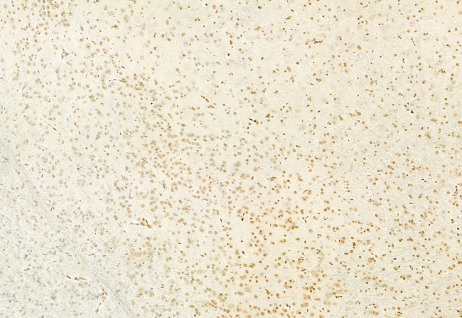 H3K4me3 Antibody in Immunohistochemistry (Paraffin) (IHC (P))