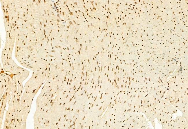 H3K4me3 Antibody in Immunohistochemistry (Paraffin) (IHC (P))