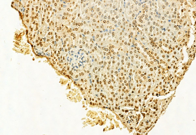 H3K4me3 Antibody in Immunohistochemistry (Paraffin) (IHC (P))