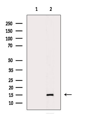 H3K9me3 Antibody in Western Blot (WB)