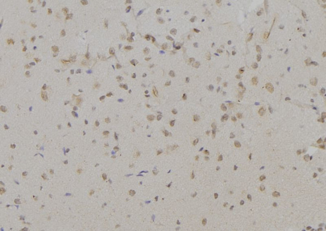 H3K9me3 Antibody in Immunohistochemistry (Paraffin) (IHC (P))