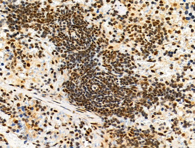 Phospho-4EBP1 (Thr37, Thr46) Antibody in Immunohistochemistry (Paraffin) (IHC (P))