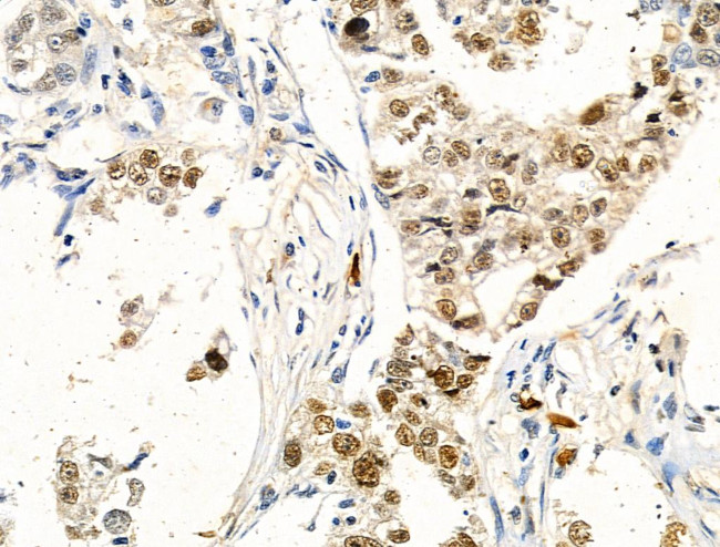 Phospho-4EBP1 (Thr37, Thr46) Antibody in Immunohistochemistry (Paraffin) (IHC (P))