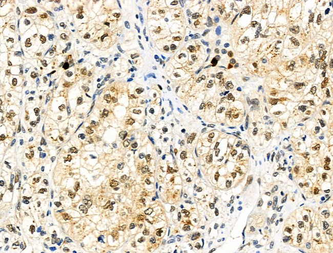 Phospho-4EBP1 (Thr37, Thr46) Antibody in Immunohistochemistry (Paraffin) (IHC (P))