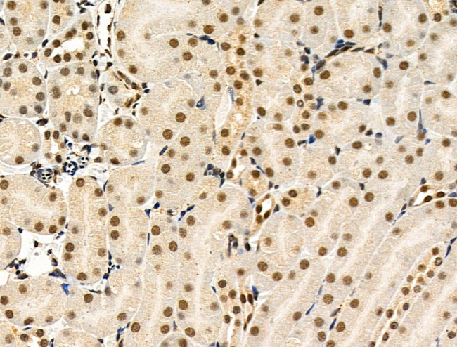 Phospho-4EBP1 (Thr37, Thr46) Antibody in Immunohistochemistry (Paraffin) (IHC (P))