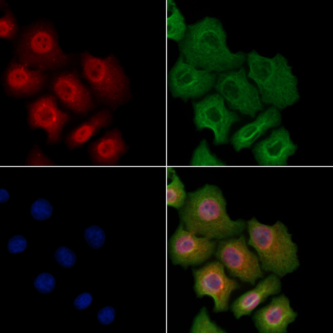 Phospho-TNFAIP3 (Ser381) Antibody in Immunocytochemistry (ICC/IF)