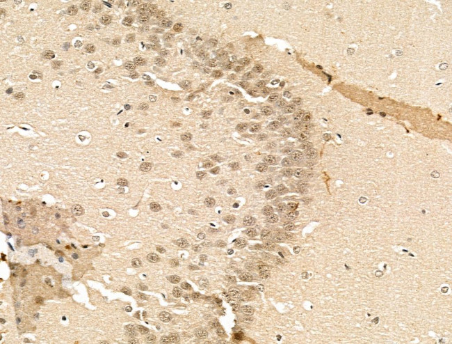 Phospho-TNFAIP3 (Ser381) Antibody in Immunohistochemistry (Paraffin) (IHC (P))