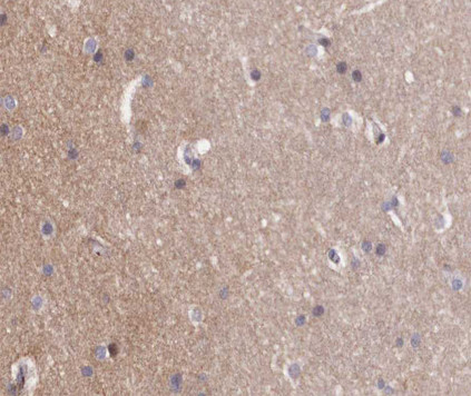 Phospho-ABL1/ABL2 (Tyr393, Tyr439) Antibody in Immunohistochemistry (Paraffin) (IHC (P))