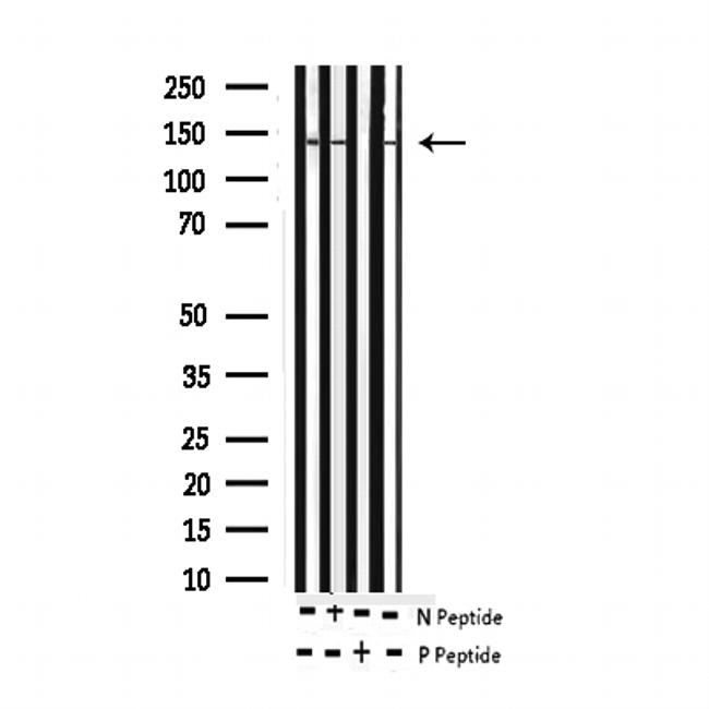 Phospho-ABL1/ABL2 (Tyr393, Tyr439) Antibody in Western Blot (WB)