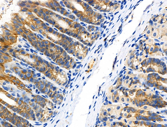 Phospho-Catenin alpha-1 (Ser655, Thr658) Antibody in Immunohistochemistry (Paraffin) (IHC (P))