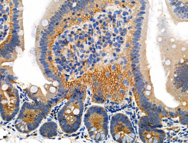 Phospho-Catenin alpha-1 (Ser655, Thr658) Antibody in Immunohistochemistry (Paraffin) (IHC (P))