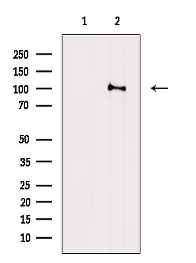 Phospho-Catenin alpha-1 (Ser655, Thr658) Antibody in Western Blot (WB)